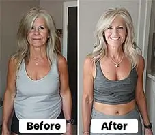 SeroBurn User Results 1