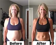 SeroBurn User Results 4